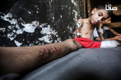 140825_Gaza_OSH_1_00(1)