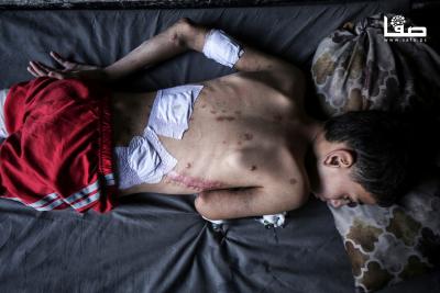 140825_Gaza_OSH_1_00(30)