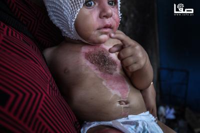 170825_Gaza_OSH_1_00(15)