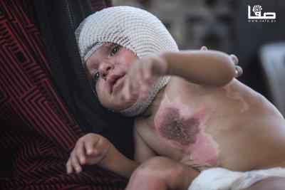 170825_Gaza_OSH_1_00(25)