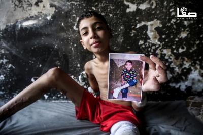 140825_Gaza_OSH_1_00(33)