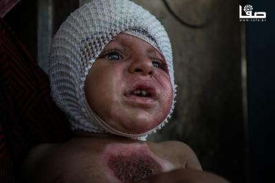 170825_Gaza_OSH_1_00(16)