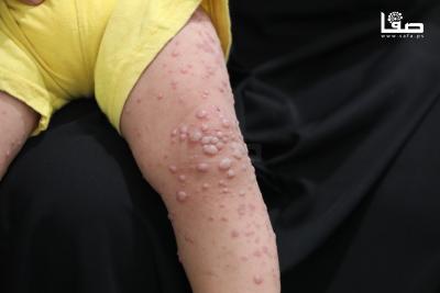 250825_Nusaierat_MS_00(15)