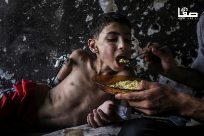 140825_Gaza_OSH_1_00(37)