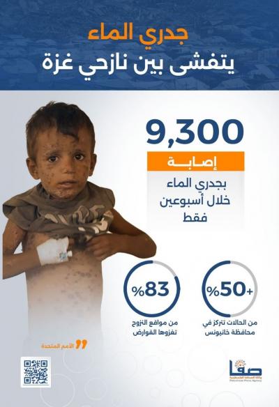 جدري الماء يتفشى بين نازحي غزة