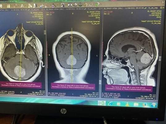 WhatsApp Image 2021-12-06 at 9.21.21 AM.jpeg